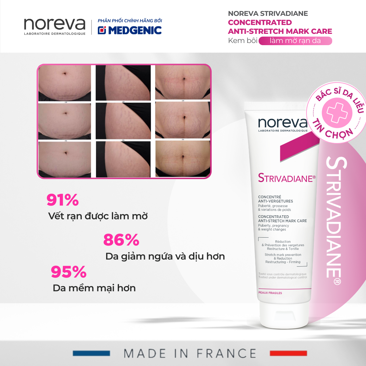 Kem Bôi Rạn Da An Toàn Cho Mẹ Bầu, Sau Sinh Và Tuổi Dậy Thì Noreva Strivadiane Concentrated Anti-Stretch Mark Care 125ml